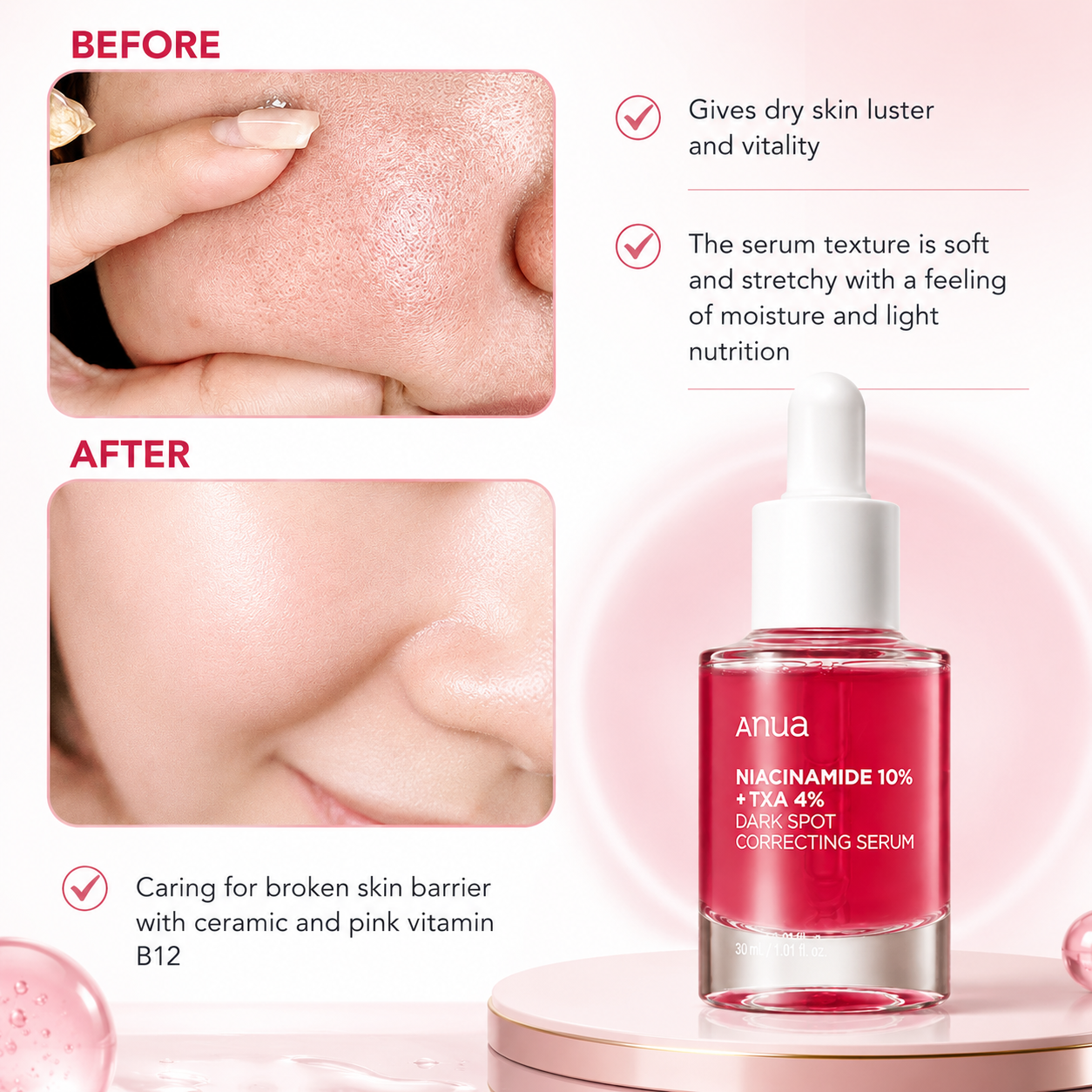 ANUA Dark Spot Correcting Serum – Niacinamide 10% + Tranexamic Acid 4%
